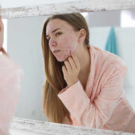 Guide complet de l'acné du dos • euroClinix®