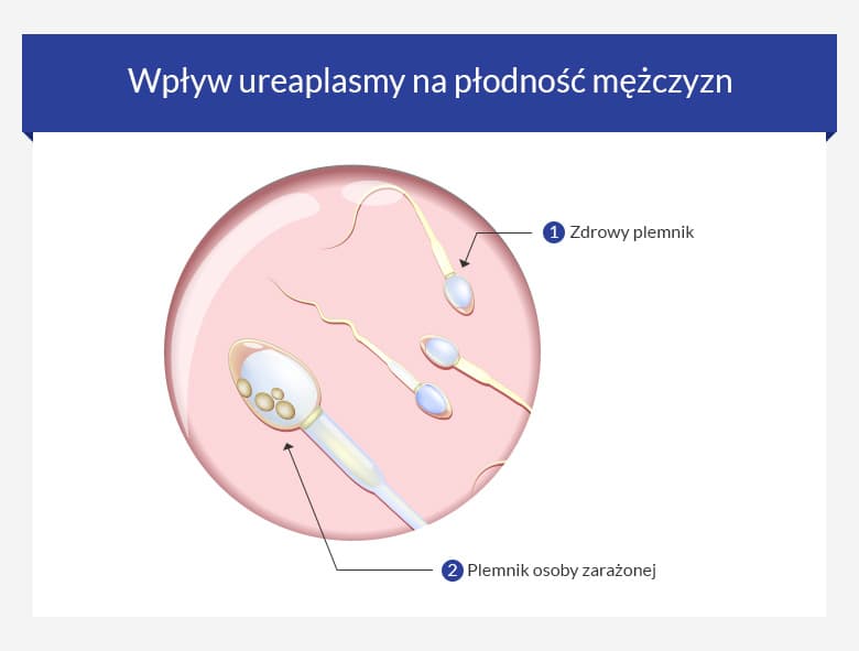 A prosztatitis antibiotikumai férfiakban Heveny prosztata gyulladás | Urológiai Klinika