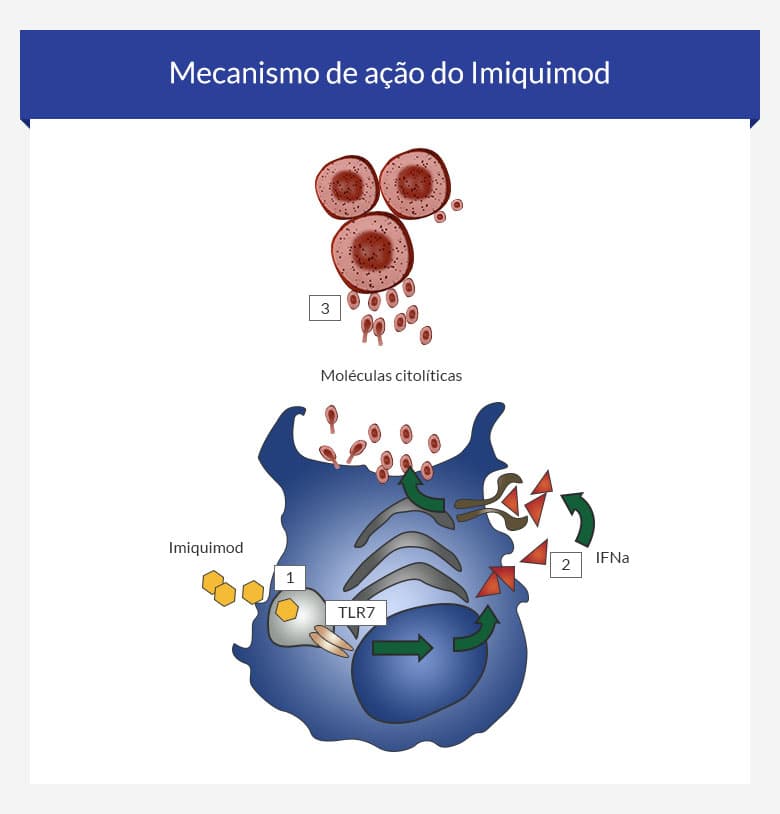 Imiquimod creme generico