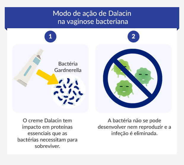 Grafik zeigt, wie Sobelin-Creme bakterielle Vaginose behandelt.