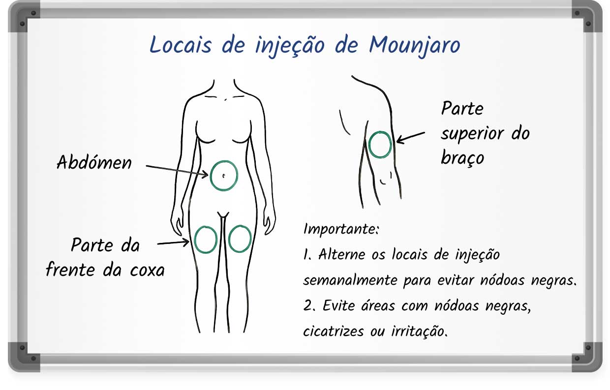 Diagrama que mostra os locais recomendados para a injeção de Mounjaro no abdómen, na parte da frente da coxa e na parte superior do braço