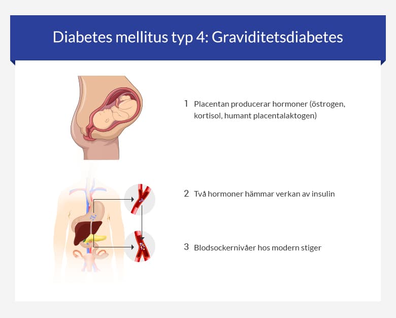 Diabetes mellitus typ 4