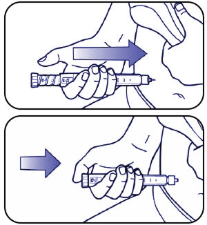 Diagram som visar hur man tar bort nålen.
                  