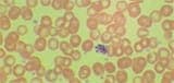Plasmodium malariae