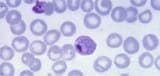 Plasmodium vivax