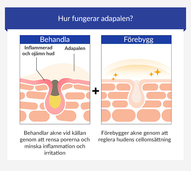 Infografik som visar hur adapalen behandlar och förebygger akne