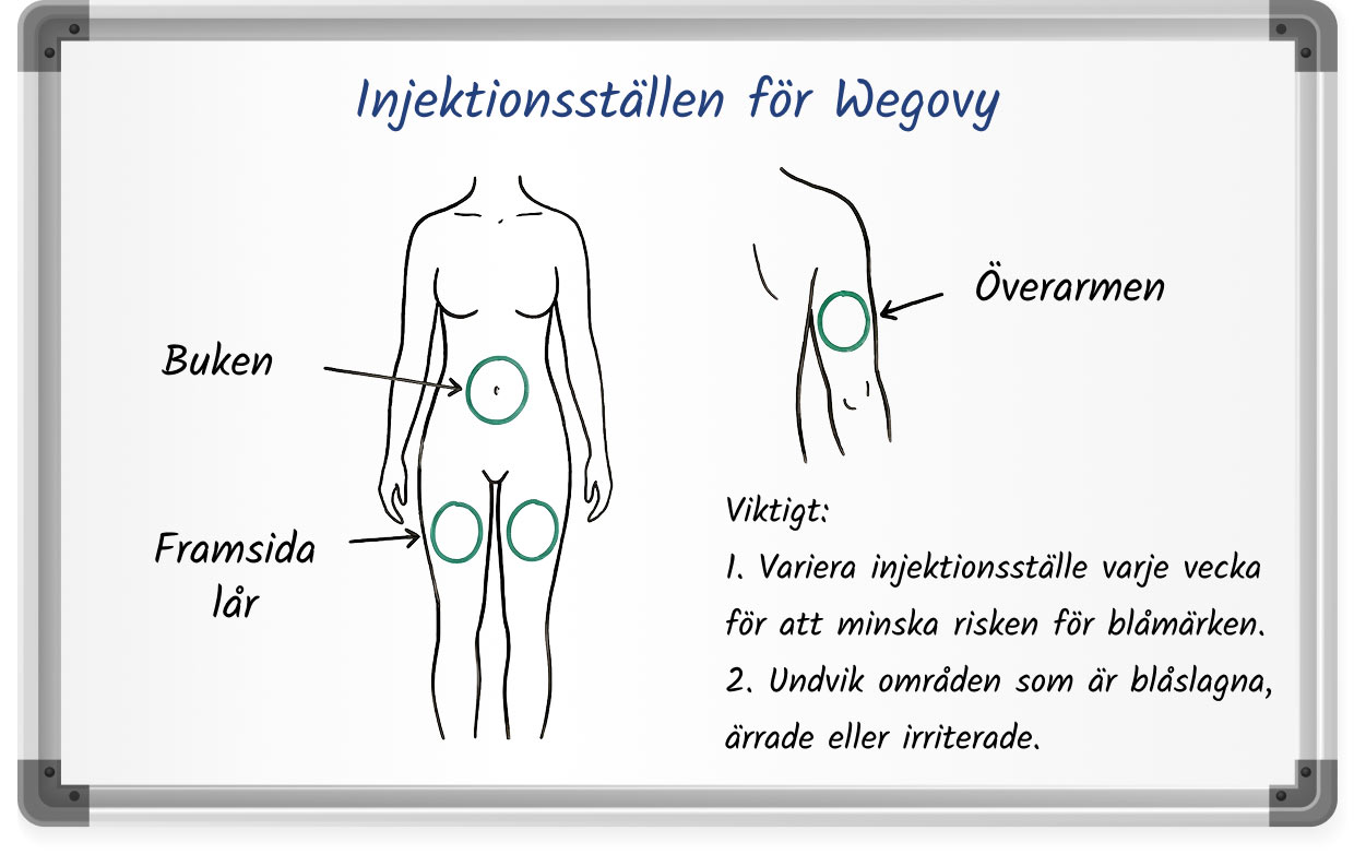 Diagram som visar rekommenderade injektionsställen för Wegovy: magen (buken), framsida lår och överarmen