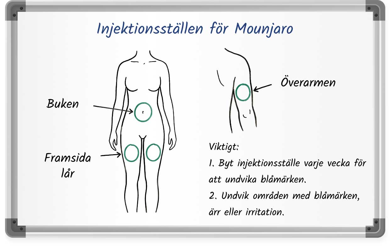 Diagram showing recommended Mounjaro injection sites on the abdomen, front of the thigh, and upper arm